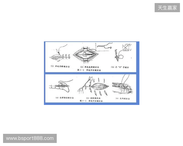 广州豹官方：杨浩眉弓伤口缝合30余针，预计5-7天后拆线